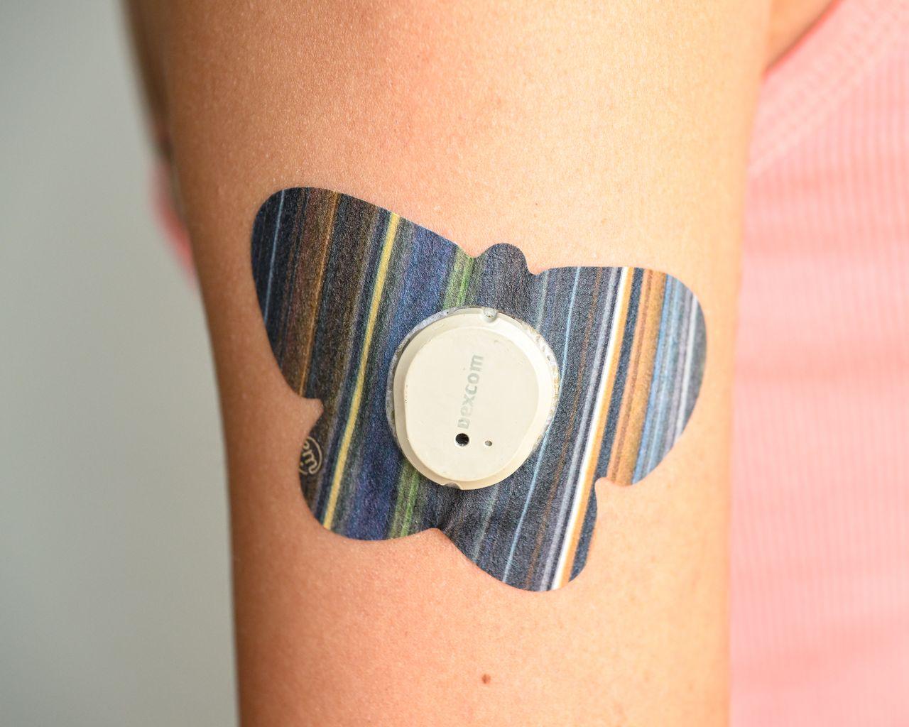 ExpressionMed Dark Stripes Infusion Set Butterfly Tape