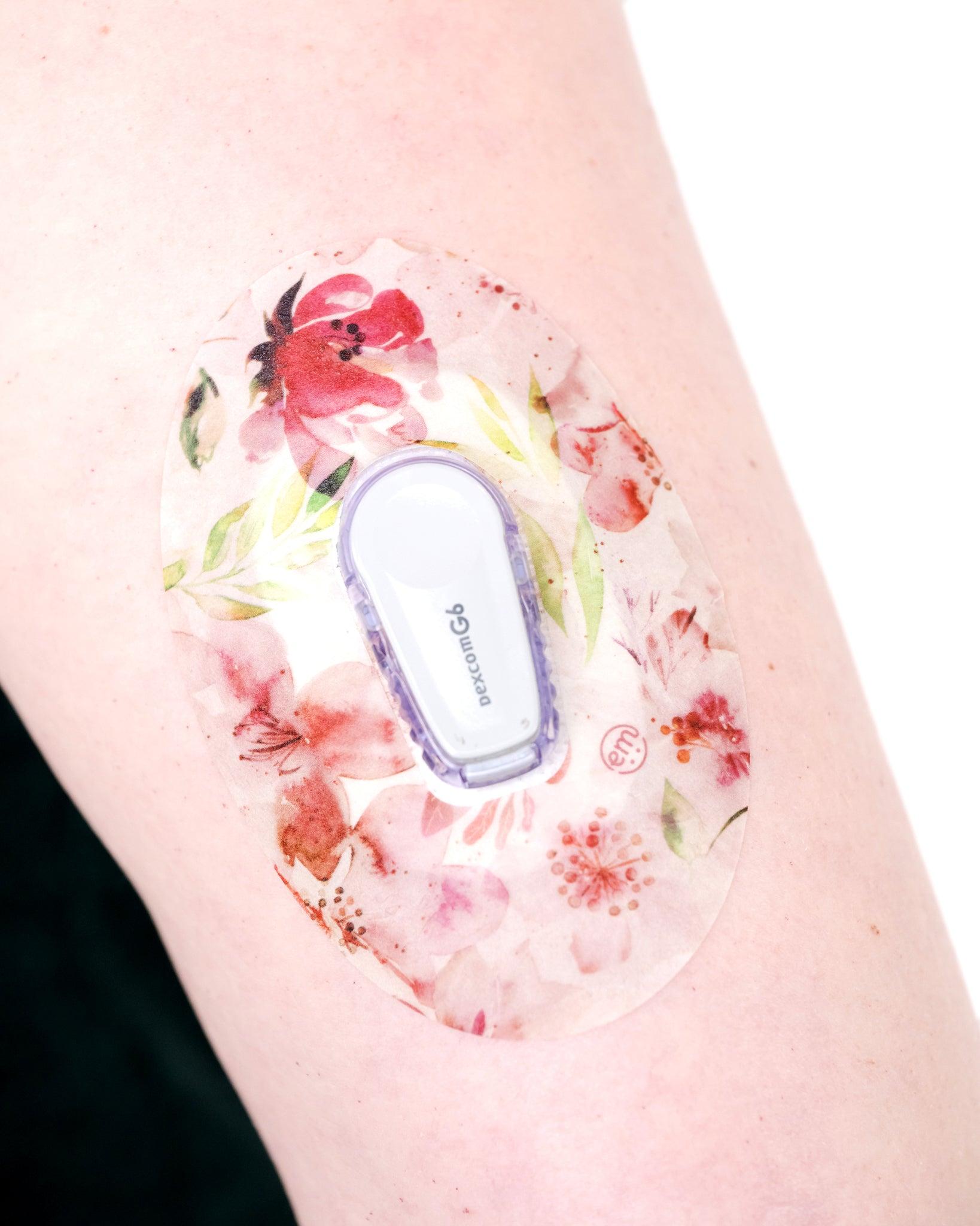 ExpressionMed Ethereal Spring Dexcom G6 Tape in use on arm