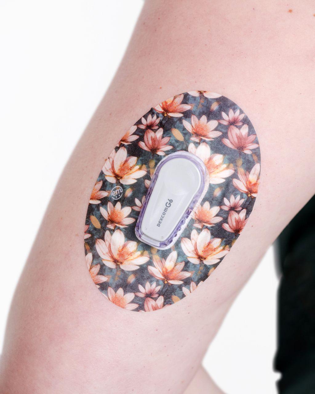 ExpressionMed Moody Moment Variety Pack Dexcom G6 Tape, Single Tape, Arm Wearing Floral Themed CGM Adhesive Patch Design