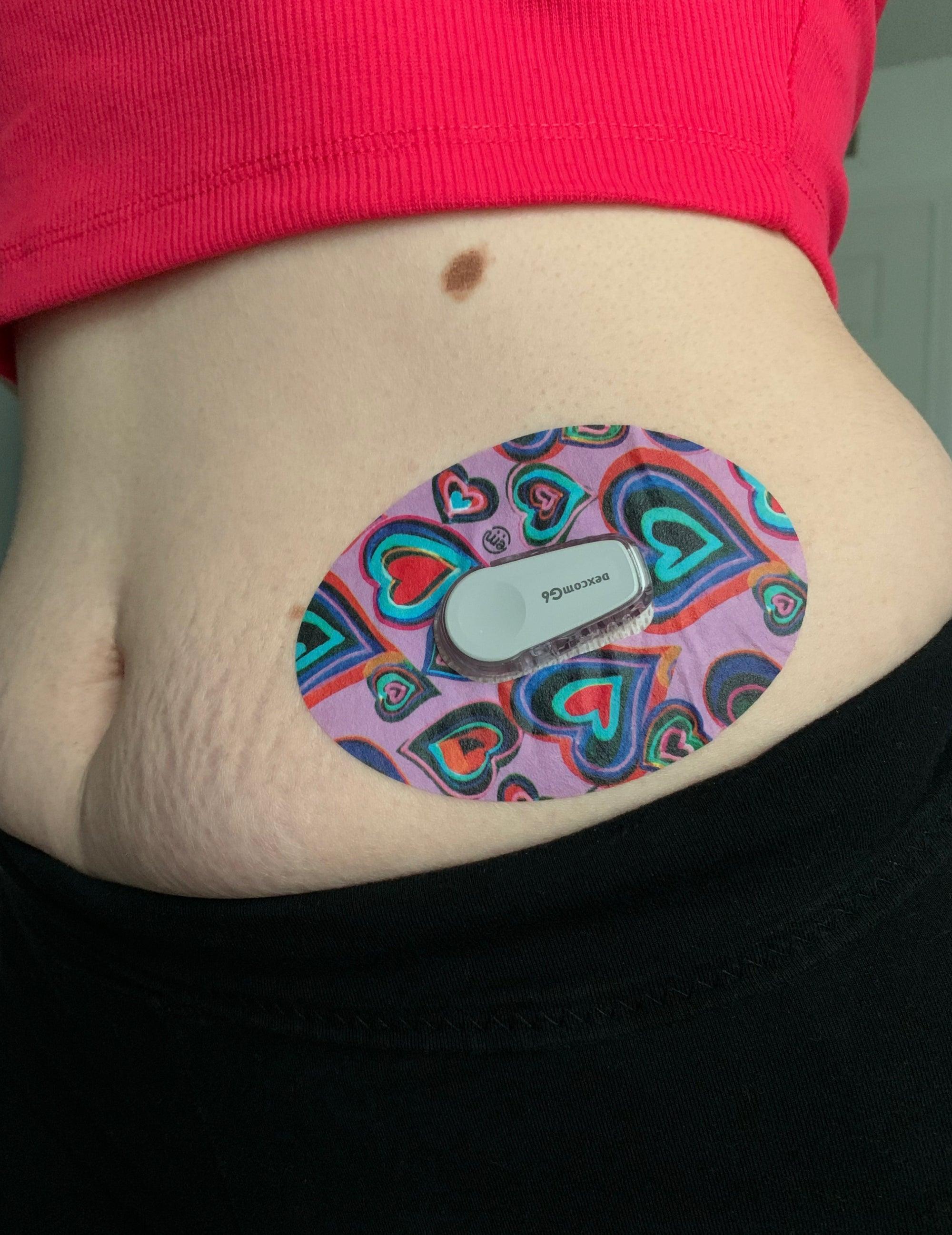 ExpressionMed Woman with Neon Hearts Dexcom G6 Tape on stomach