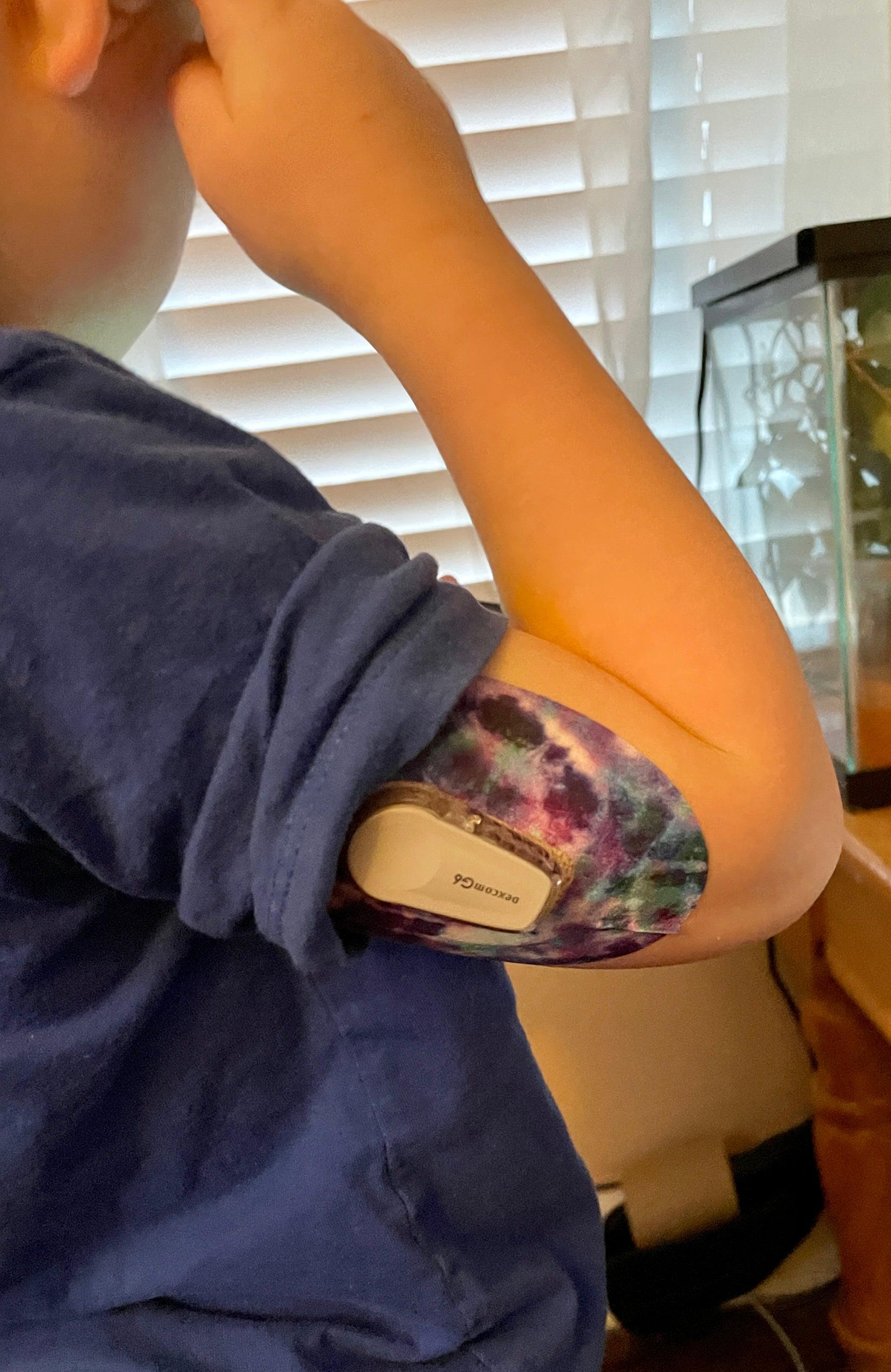 ExpressionMed Purple Power Variety Pack Dexcom G6 Tape, Single Tape, Boy  Wearing Tie Dye Themed CGM Adhesive Patch Design