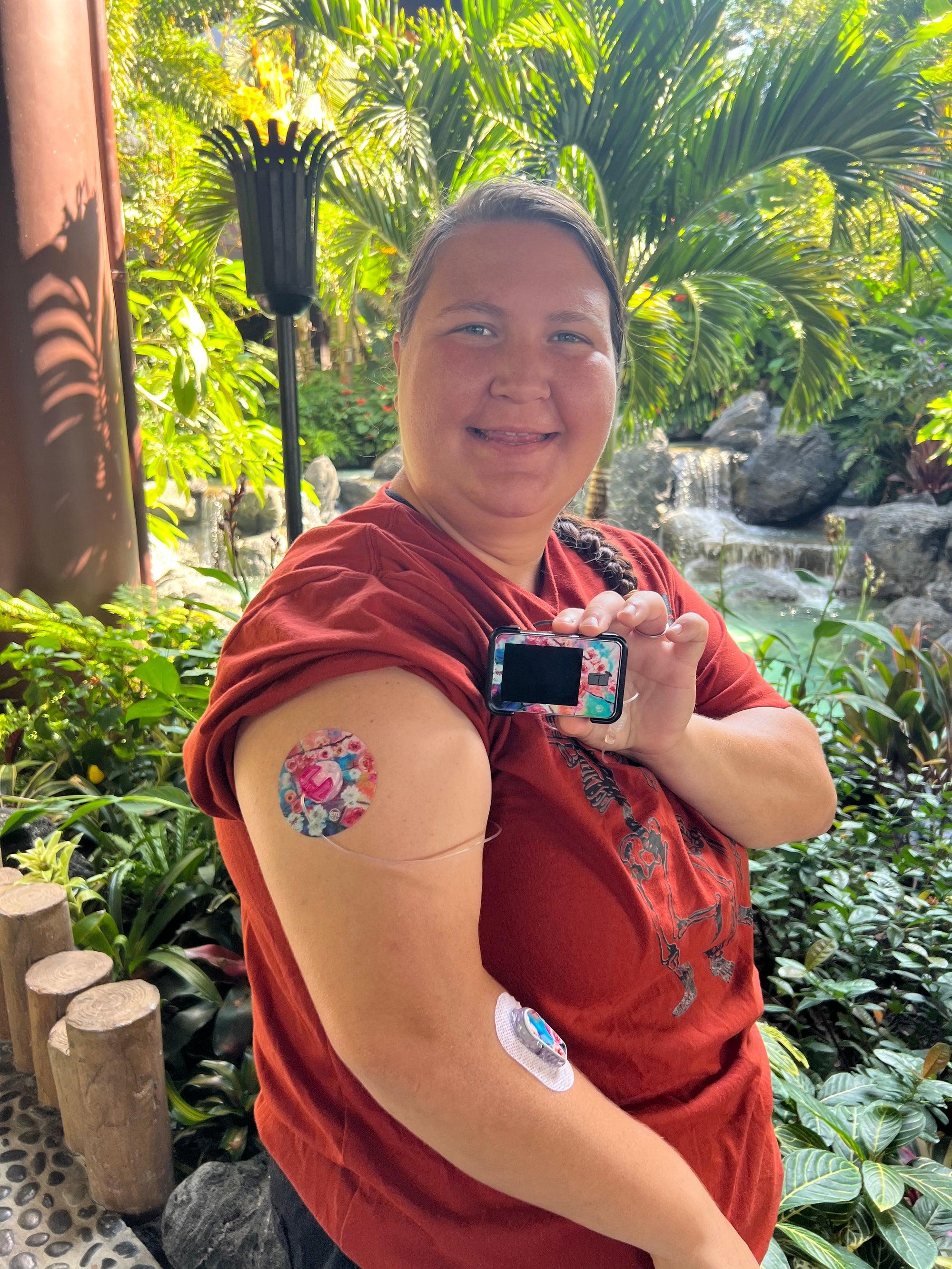Woman with branching out infusion set tape on arm