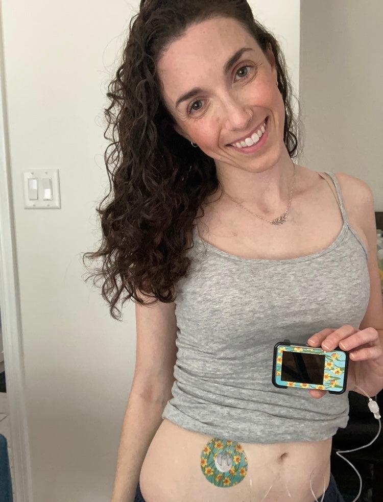 Woman with Daffodils Infusion Set Tape on stomach