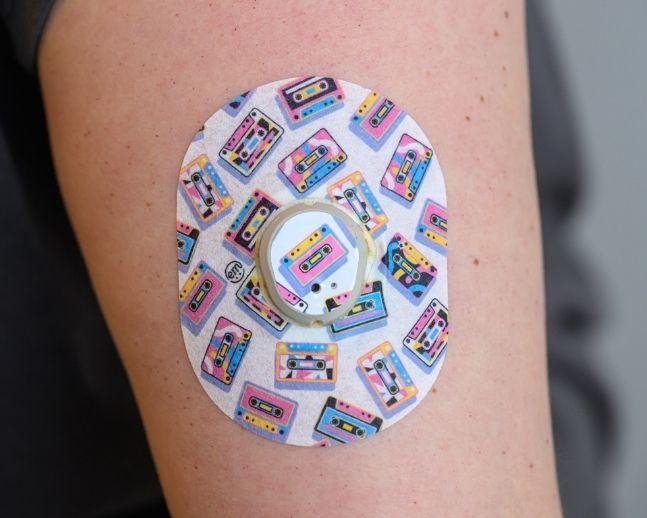 ExpressionMed, Vintage Music Tapes Dexcom G7 and Stelo Transmitter Sticker, Tape & Sticker, Human Wearing Music Tapes Themed CGM Adhesive Patch Design