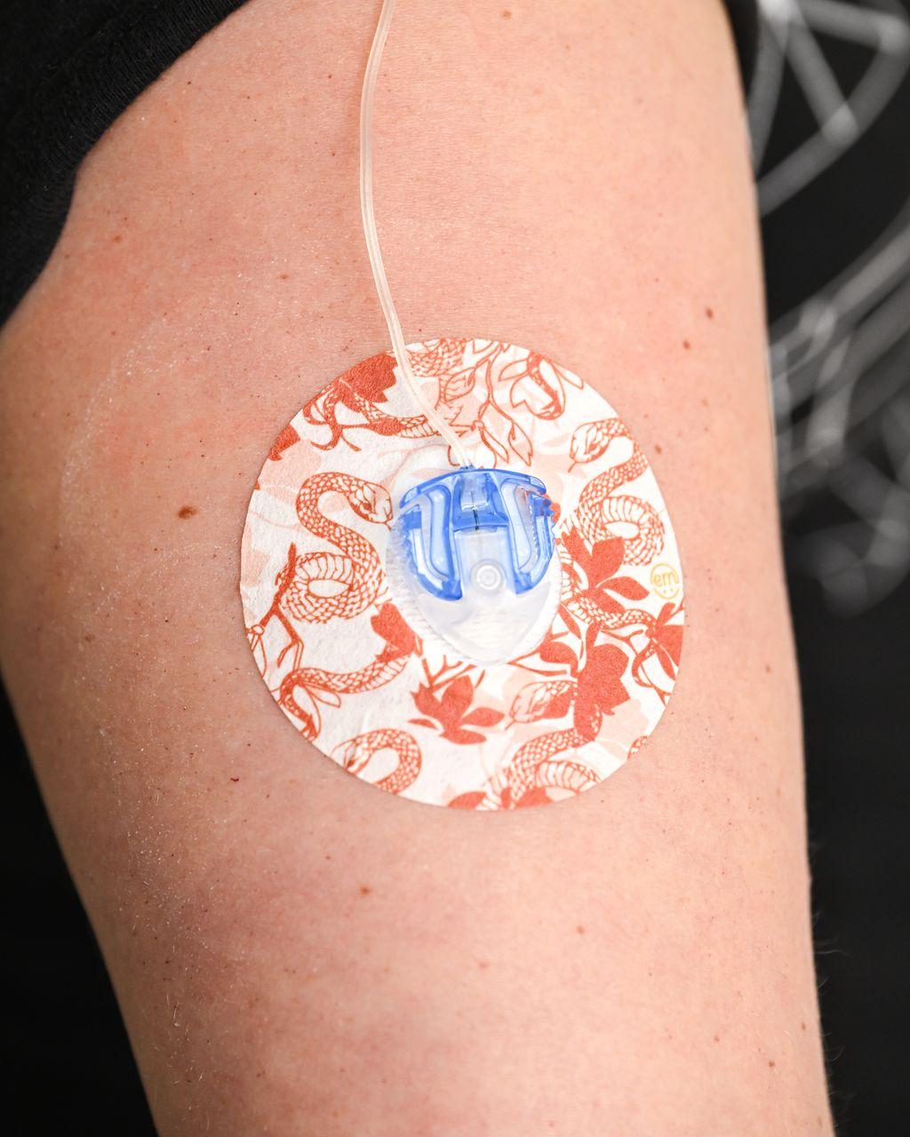 ExpressionMed, Lava Coil Floral Infusion Set Tape, Sticker Only, Arm Wearing Lava Themed CGM Adhesive Patch Design