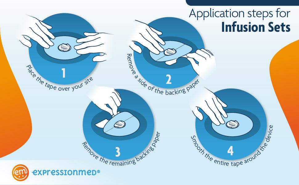 ExpressionMed Infusion Set Tape Application