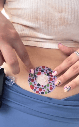 Woman with Wild Berries Infusion Set Tape on stomach