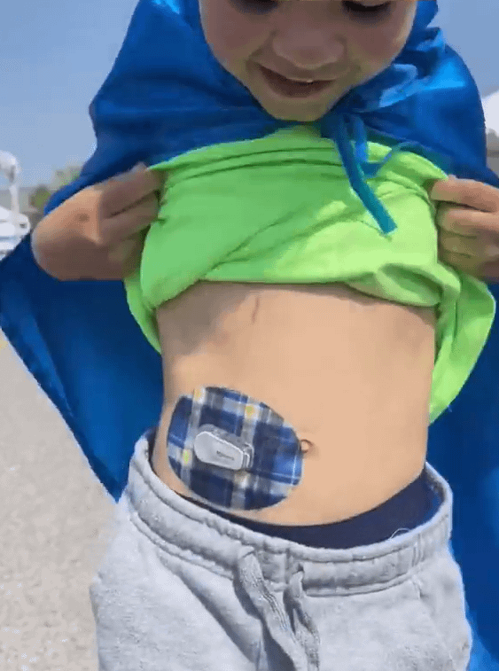 Little boy with Blue Plaid Dexcom G6 Tape on stomach