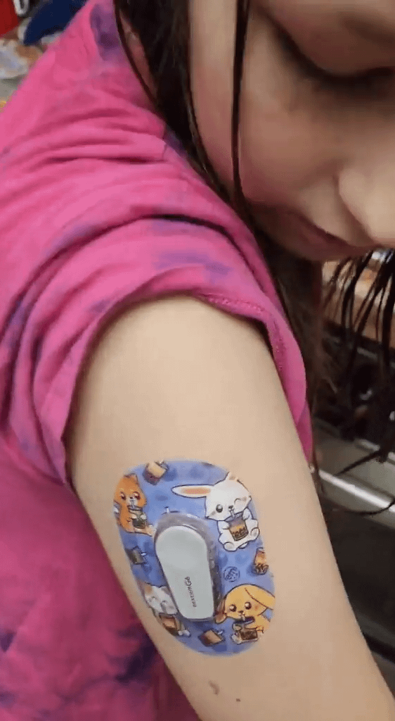 Little girl with Boba Buddies Dexcom G6 Mini Tape on arm