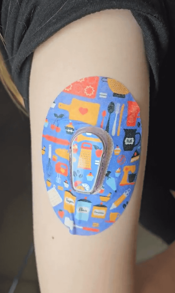 Baking Dexcom G6 Tape and Transmitter Sticker on little girl's arm
