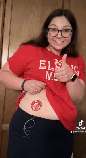 ExpressionMed Woman with Gingerbread Fun Infusion Set Tape on stomach