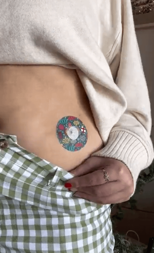 Woman with Tree Sparkles Infusion Set Tape on stomach
