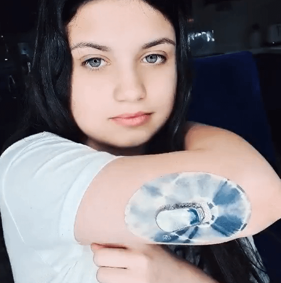 ExpressionMed Girl with Overcast Tie Dye Dexcom G6 Tape and Transmitter Sticker on arm