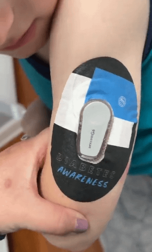 ExpressionMed Boy with diabetes awareness dexcom G6 tape on arm