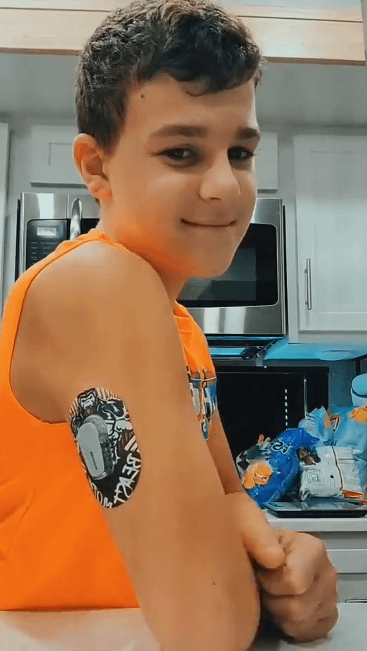 Boy with beast mode dexcom G6 mini tape on arm