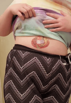 ExpressionMed Woman with rustic marble Dexcom G6 tape on stomach