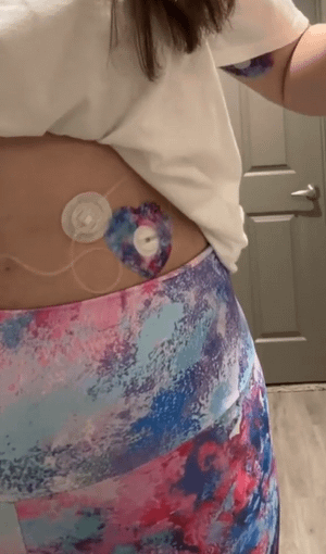 Woman with Ascendant, the Rise Heart Infusion Set Tape on stomach and wearing leggings to match