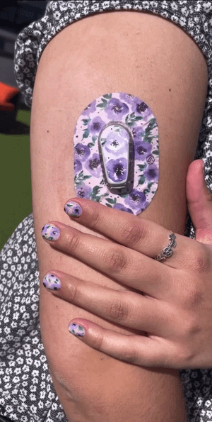 ExpressionMed Woman with Flowering Amethyst Dexcom G6 Mini Tape on arm and nails to match