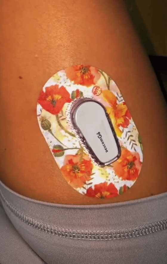 ExpressionMed Peachy Blooms Dexcom G6 Mini Tape in use on leg
