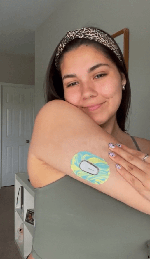 ExpressionMed Woman with Mixed Playdough Dexcom G6 Mini Tape on arm