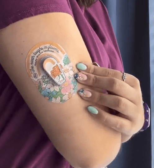 ExpressionMed Woman with Laughing Blooms Dexcom G6 Mini Tape and transmitter sticker on arm