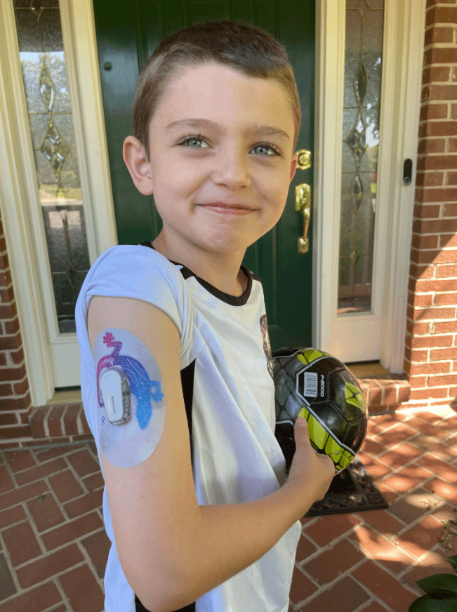 ExpressionMed Little boy with Ombre Gecko Dexcom G6 Tape on arm