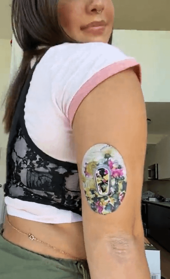 Woman with Wild Blossoms Dexcom G6 Tape on arm