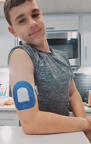 ExpressionMed Boy with watercolor waves pod tape on arm