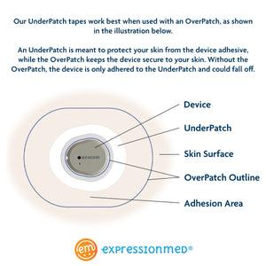 ExpessionMed's Illustration showing the use of an underpatch and overpatch for securing a device. The underpatch protects the skin from the device adhesive, while the overpatch ensures the device stays secure. Without the overpatch, the device may not stay attached as it is only adhered to the underpatch