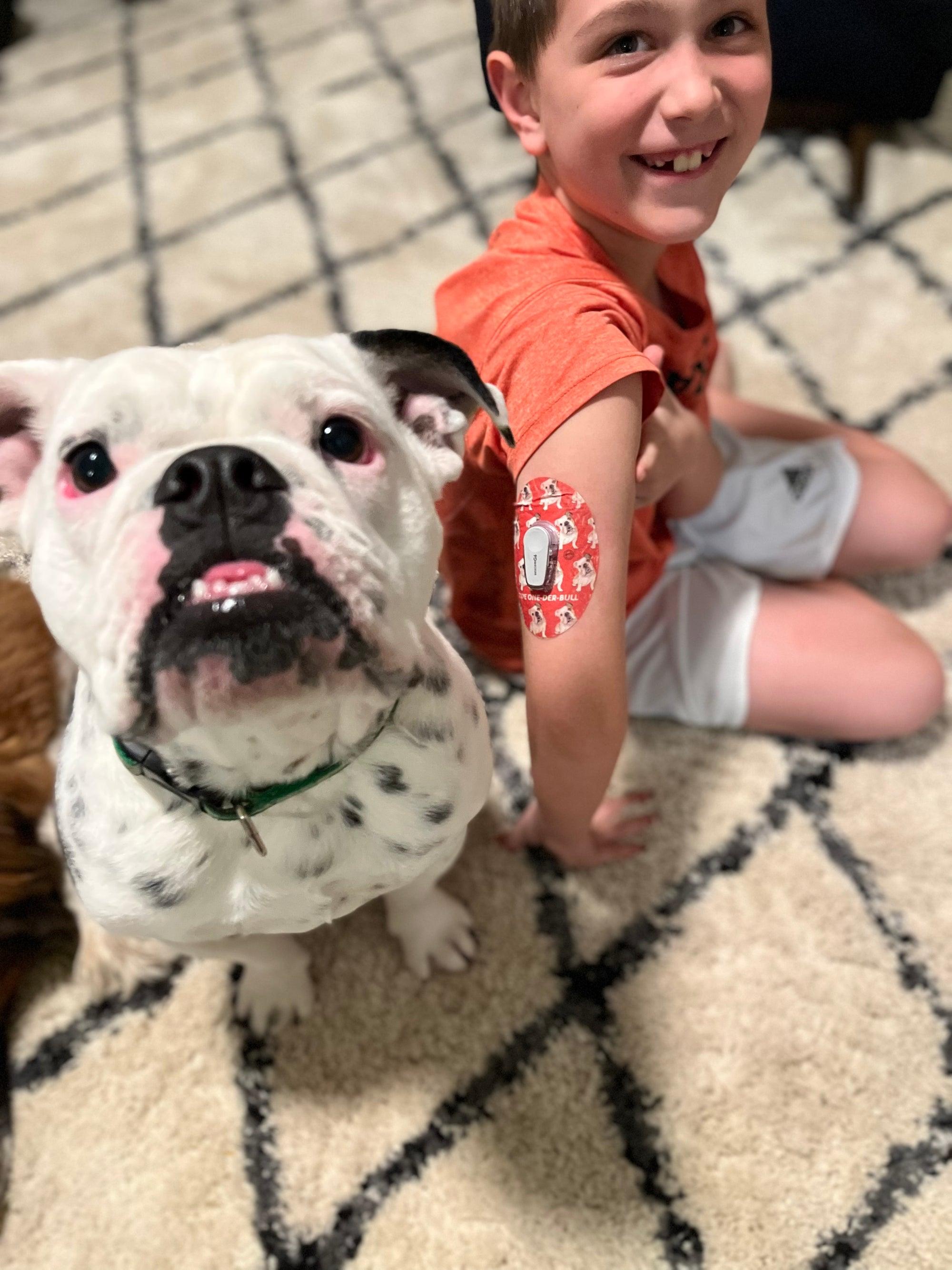 ExpressionMed Crazy Canine Variety Pack Dexcom G6 Tape, Single Tape, Boy Wearing Dog Themed CGM Adhesive Patch Design