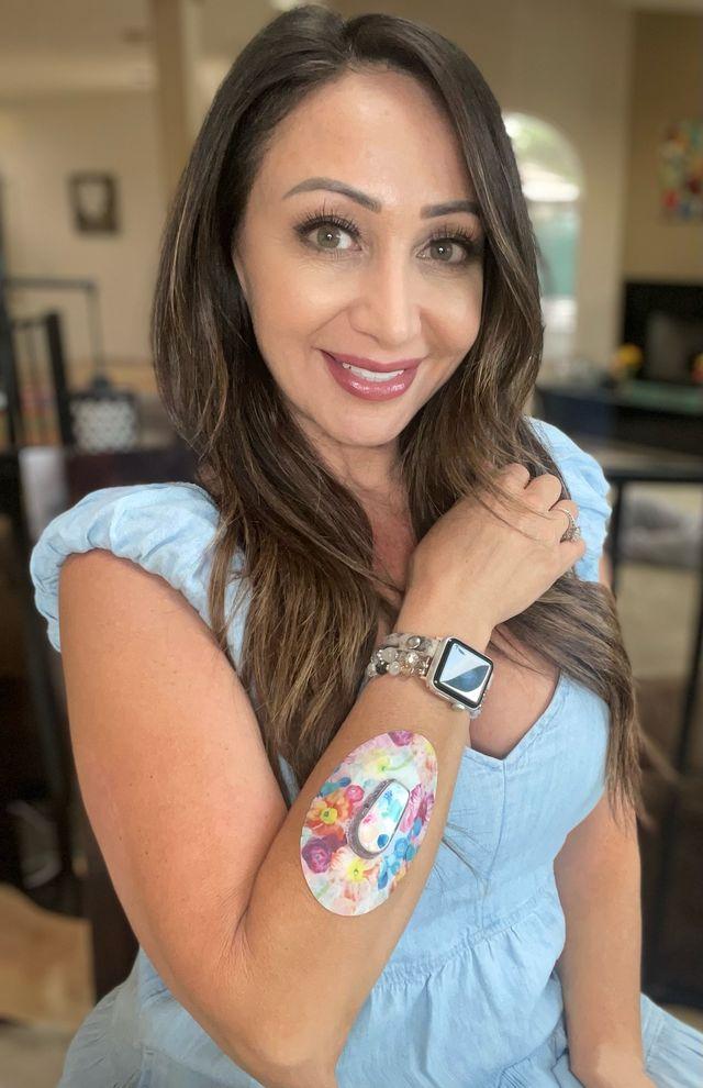 ExpressionMed Bee Treat Variety Pack Dexcom G6 Tape