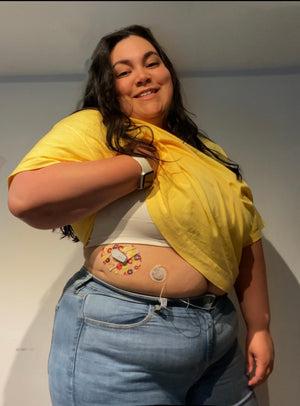 Woman with Citrus Slices Dexcom G6 Tape on stomach