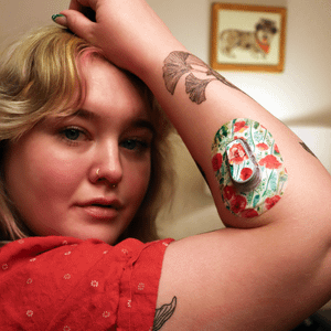 Woman with Wild Poppies Dexcom G6 Mini Tape and Transmitter Sticker on arm